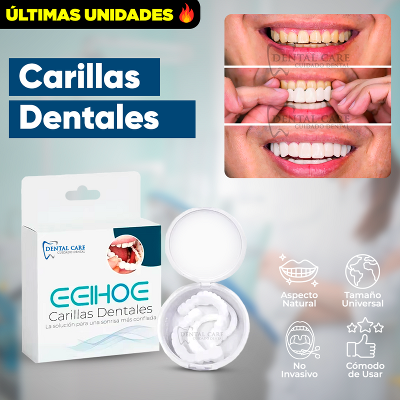 Carillas Dentales Naturales Removible - DentalCare®