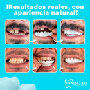Carillas Dentales Naturales Removible - (Llévate 2 Kits Paga 1) G