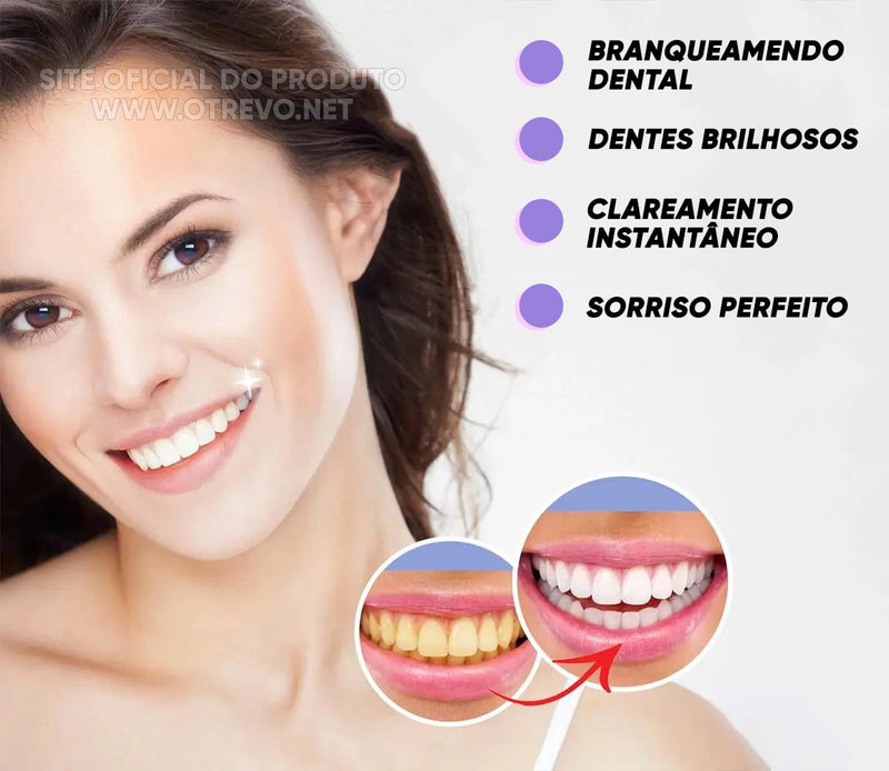 Brillo Blanqueador dental instantáneo- SMILEKIT®